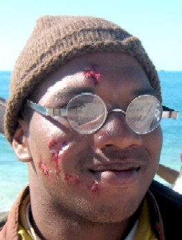 Re-enactor Reggie - Fake Syphilitic Wounds